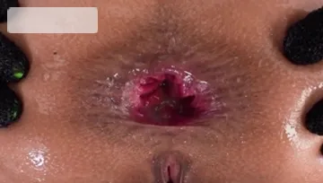 Anal Only: Gorgeous Chloe Amour gaping gets drilled